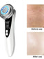 5-In-1 Facial Massager: LED Light Therapy, Eye Care, Skin Smoothing, USB Rechargeable