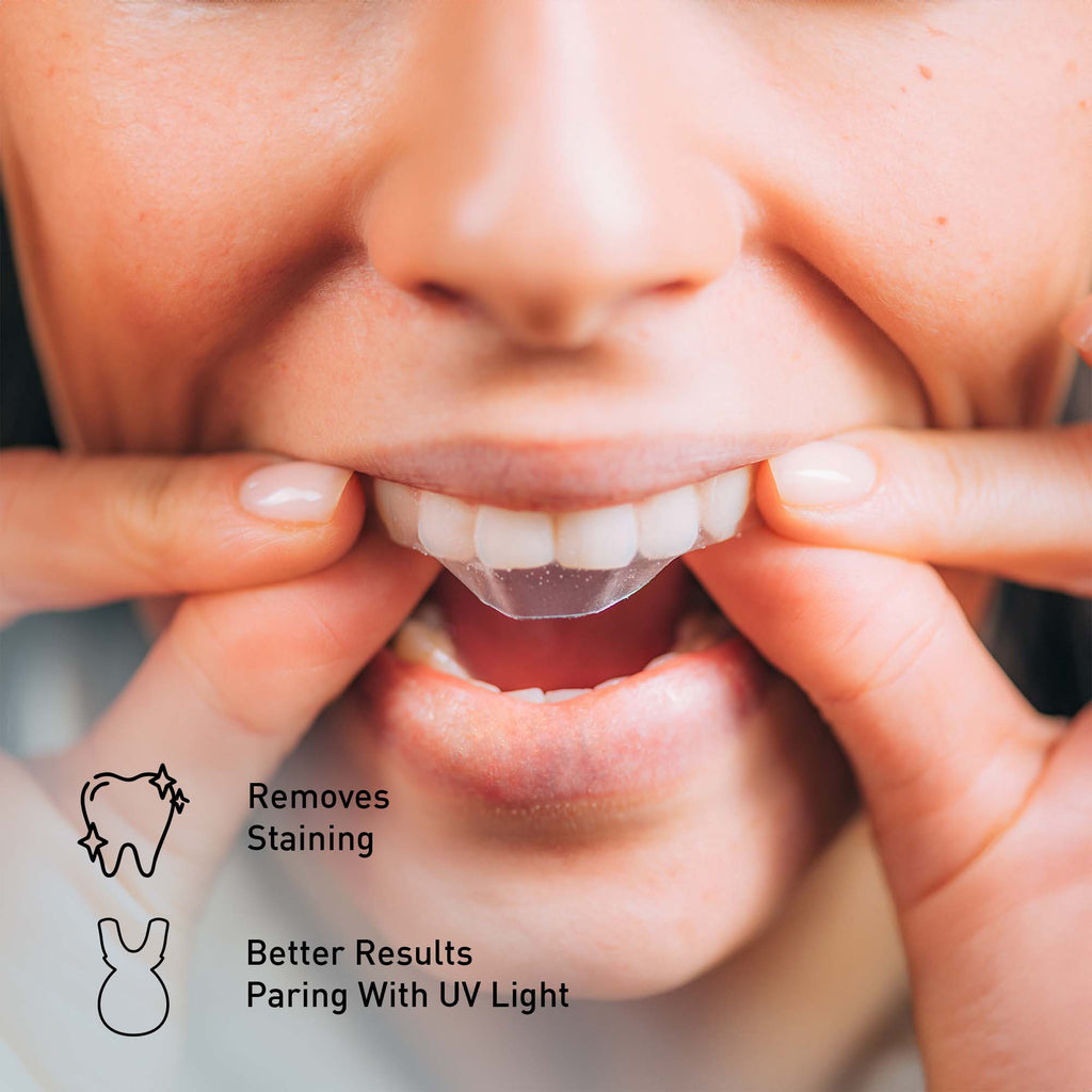 Pursonic Advanced Smile Care Bundle – LED Whitening Kit, Whitening Strips, & Electric Toothbrush